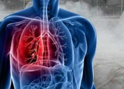 Limiter les risques liés aux poussières de silices